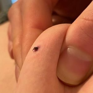 Can anyone tell if this is a tick or not? Can anyone tell if this is a tick or not?