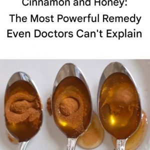 Cinnamon and Honey: The Most Powerful Remedy Even Doctors Can’t Explain Cinnamon and Honey: The Most Powerful Remedy Even Doctors Can’t Explain