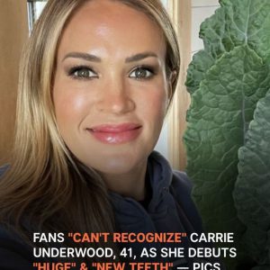 Carrie Underwood, 41, Sparks Stir as Fans Claim She ‘Does Not Look Like’ Herself and Suspect ‘New Teeth’ Carrie Underwood, 41, Sparks Stir as Fans Claim She ‘Does Not Look Like’ Herself and Suspect ‘New Teeth’