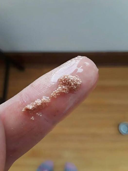 Egg Mystery Solved: What Those White Specks Actually Are