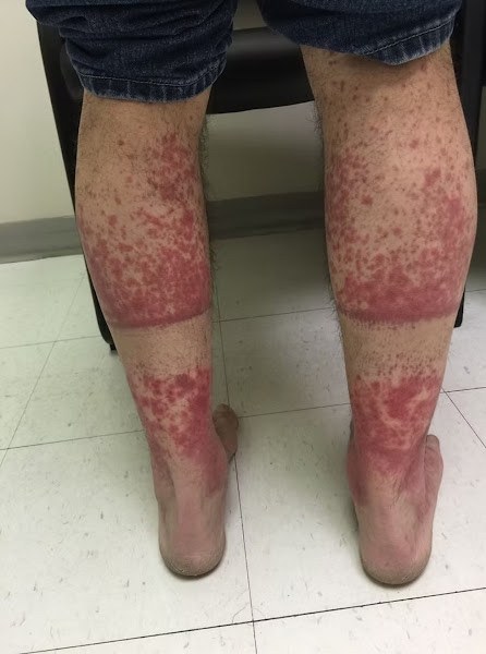 The emotional effects of sleeping with the wrong person