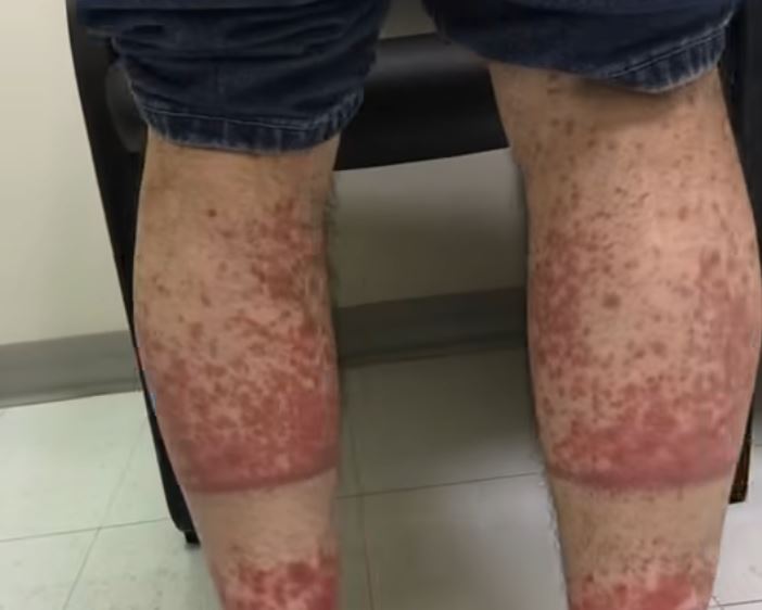 Here Are Some Problems That Can Occur If You Don’t Get Proper Sleep