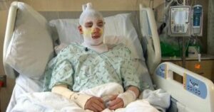 Uncle left with third-degree burns after running into burning building to save 8-year-old girl