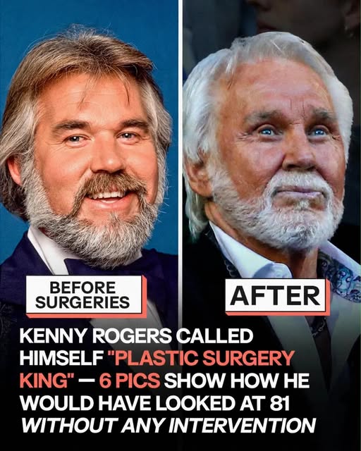 A Look at Kenny Rogers’ Transformation Over the Years: An AI Perspective