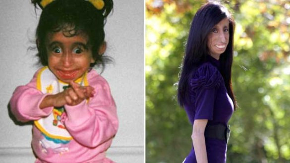 THE WORLD’S THINNEST WOMAN’S BATTLE AGAINST ANOREXIA WILL LEAVE YOU SPEECHLESS!