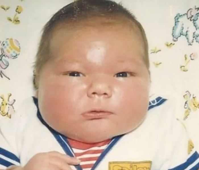 The 16-Pound Baby from 1983: See Him Now