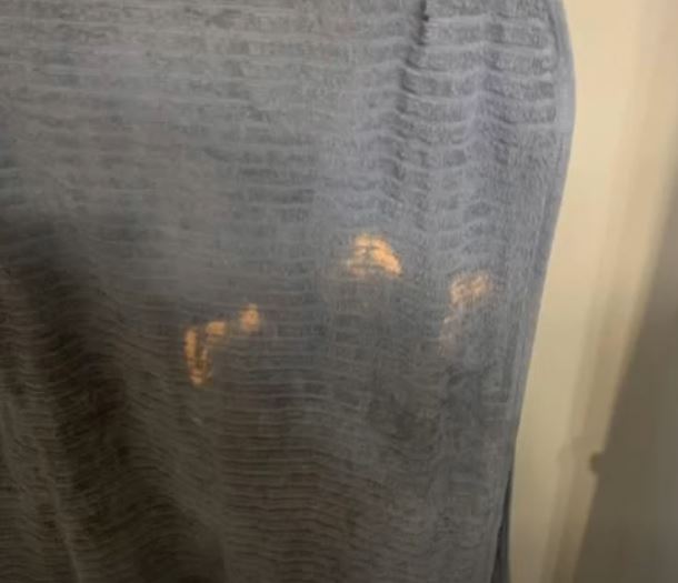 The Real Reason Orange Towel Marks Keep Coming Back