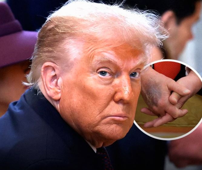 Donald Trump Returns to Hospital for New Tests — Three Months After His Diagnosis