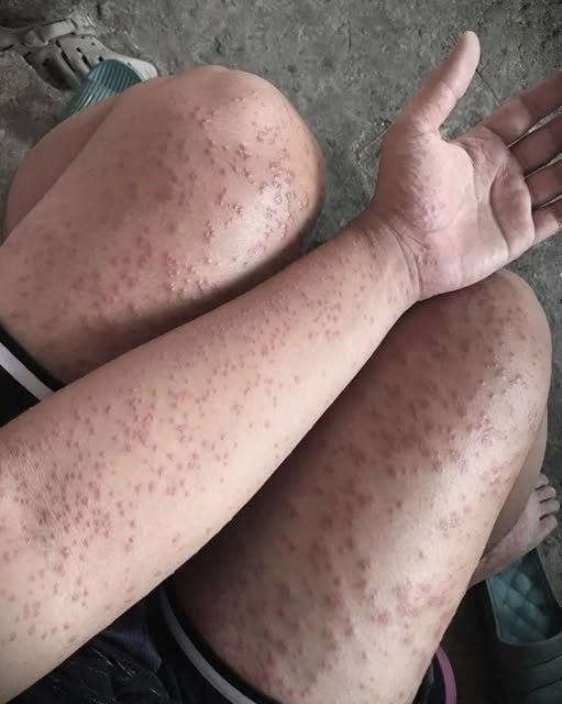 What Happens to Your Body When You Don’t Get Enough Sleep