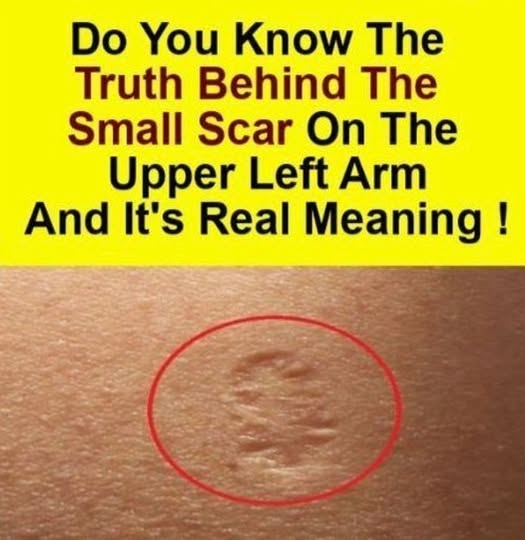 You’ve Seen This Scar Before — But Do You Know Why It’s There?