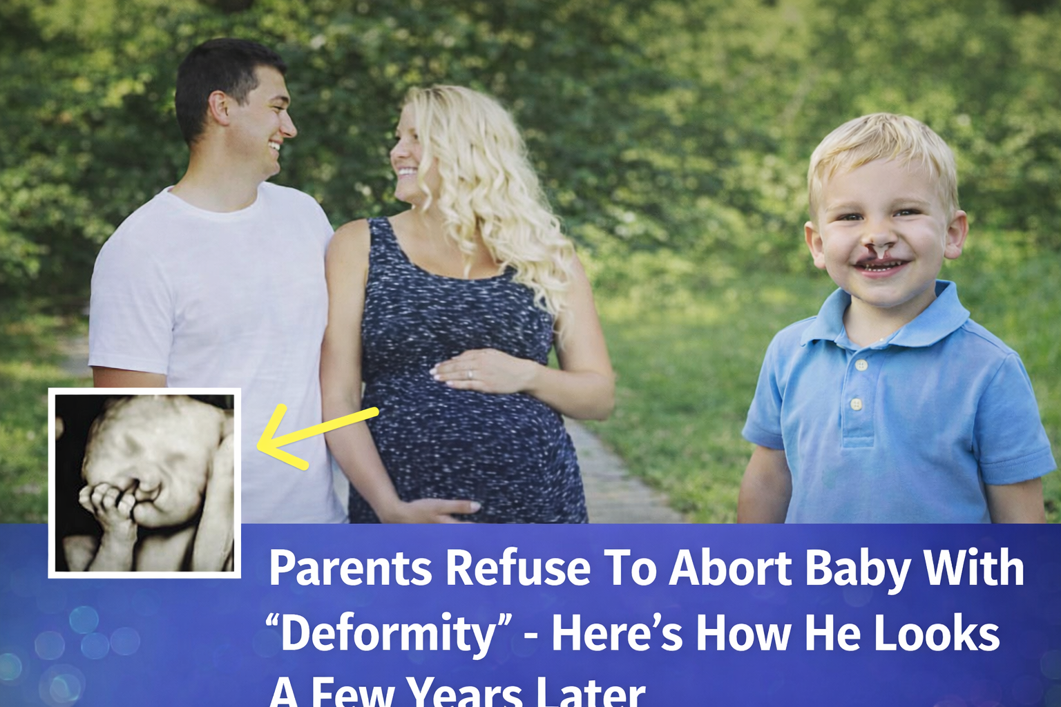 Parents Refuse to Give Up on Their Baby — Here’s How He Looks Years Later