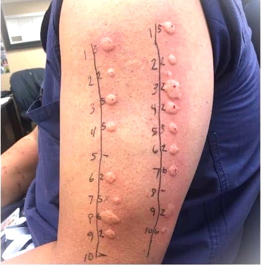 Sleeping With the Wrong Person Can Lead to..