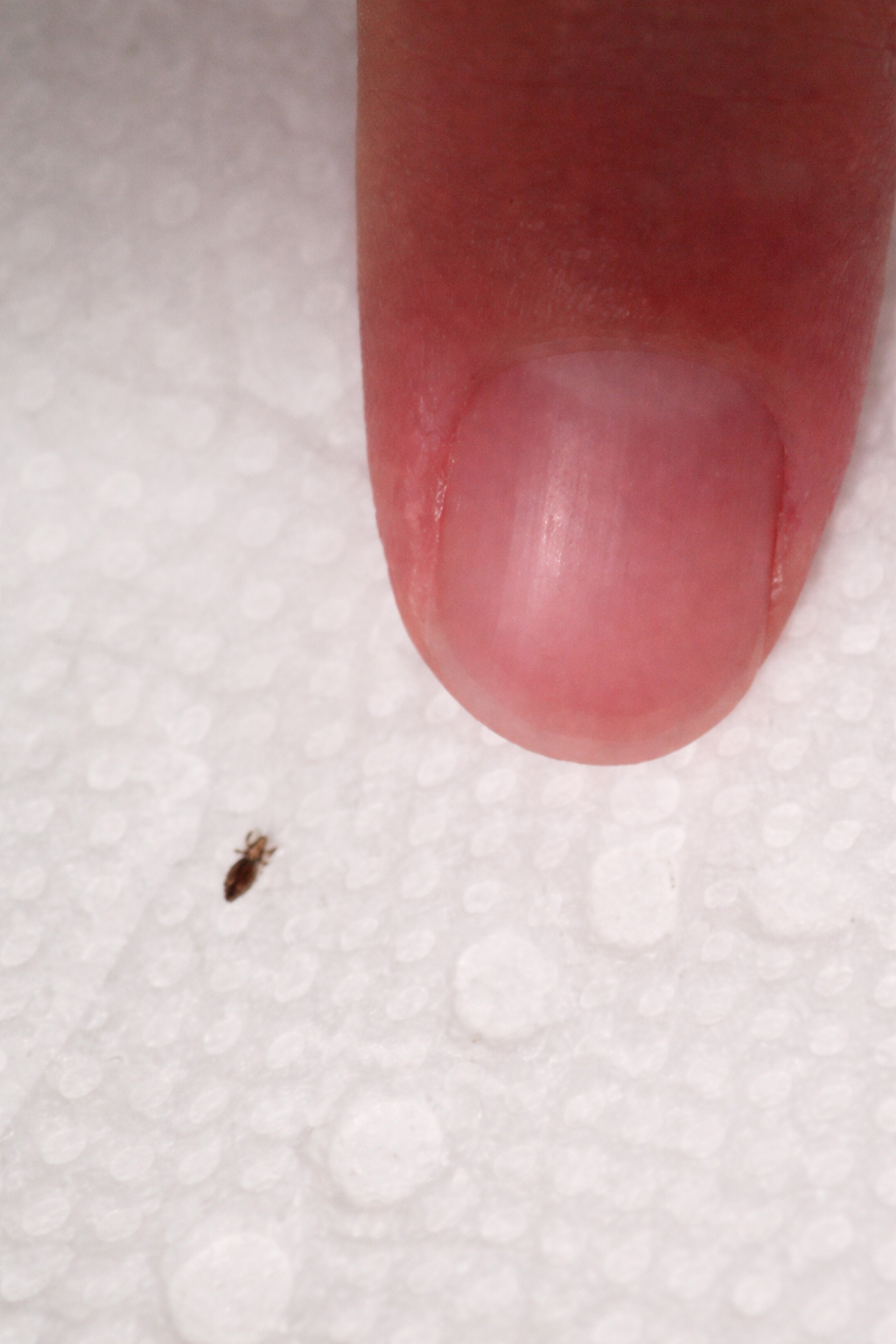 What to Do If an Insect Gets Caught in Your Hair