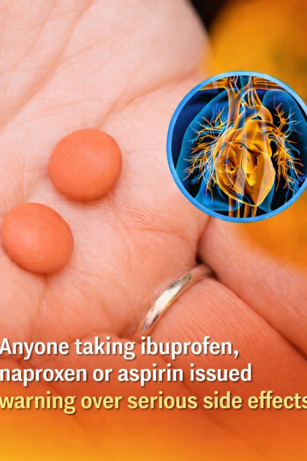 Warning Issued Over Serious Side Effects for Those Using Ibuprofen, Naproxen, or Aspirin